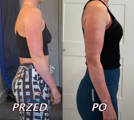 🔥boeloes korektor postawy